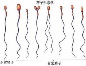 精子形态